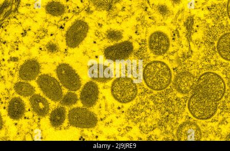 VIRUS DE LA VARIOLE DU SINGE. Cette image microscopique électronique (EM) a représenté un virion de la variole du singe, obtenu à partir d'un échantillon clinique associé à l'éclosion de chien de prairie de 2003. Il s'agissait d'une image de coupe mince d'un échantillon de peau humaine. À gauche se trouvaient des particules de virus matures de forme ovale, et à droite, des croissants et des particules sphériques de virions immatures. Banque D'Images