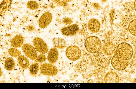 VIRUS DE LA VARIOLE DU SINGE. Cette image microscopique électronique (EM) a représenté un virion de la variole du singe, obtenu à partir d'un échantillon clinique associé à l'éclosion de chien de prairie de 2003. Il s'agissait d'une image de coupe mince d'un échantillon de peau humaine. À gauche se trouvaient des particules de virus matures de forme ovale, et à droite, des croissants et des particules sphériques de virions immatures. Banque D'Images