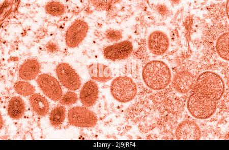 VIRUS DE LA VARIOLE DU SINGE. Cette image microscopique électronique (EM) a représenté un virion de la variole du singe, obtenu à partir d'un échantillon clinique associé à l'éclosion de chien de prairie de 2003. Il s'agissait d'une image de coupe mince d'un échantillon de peau humaine. À gauche se trouvaient des particules de virus matures de forme ovale, et à droite, des croissants et des particules sphériques de virions immatures. Banque D'Images