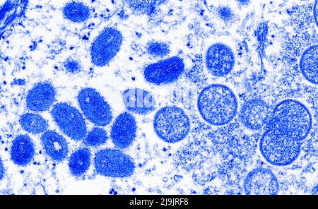 VIRUS DE LA VARIOLE DU SINGE. Cette image microscopique électronique (EM) a représenté un virion de la variole du singe, obtenu à partir d'un échantillon clinique associé à l'éclosion de chien de prairie de 2003. Il s'agissait d'une image de coupe mince d'un échantillon de peau humaine. À gauche se trouvaient des particules de virus matures de forme ovale, et à droite, des croissants et des particules sphériques de virions immatures. Banque D'Images