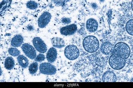 VIRUS DE LA VARIOLE DU SINGE. Cette image microscopique électronique (EM) a représenté un virion de la variole du singe, obtenu à partir d'un échantillon clinique associé à l'éclosion de chien de prairie de 2003. Il s'agissait d'une image de coupe mince d'un échantillon de peau humaine. À gauche se trouvaient des particules de virus matures de forme ovale, et à droite, des croissants et des particules sphériques de virions immatures. Banque D'Images