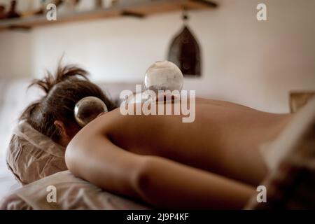 Jeune femme détendue recevant un traitement de cupping sur le dos, médecine traditionnelle chinoise. Banque D'Images