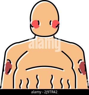 illustration vectorielle de l'icône de couleur de l'endocrinologie de la maladie de cushing Illustration de Vecteur