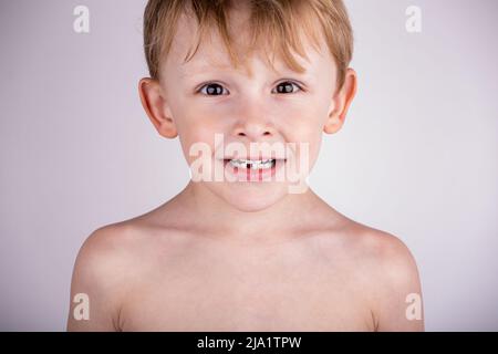 Perte de la première dent de bébé chez un enfant Banque D'Images