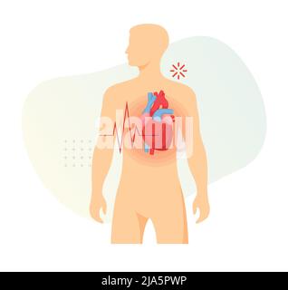 Symptômes de crise cardiaque - icône de stock comme fichier EPS 10 Illustration de Vecteur