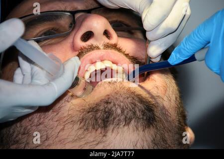 Un homme avec une barbe légère subissant une procédure dentaire Banque D'Images