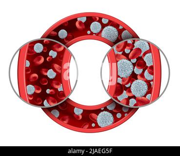 Leucémie maladie du sang concept comme un cancer des cellules blanches comme maladie lymphocytaire aiguë comme une illustration de 3D. Banque D'Images