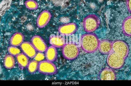 Cette image microscopique électronique (EM) a représenté un virion de la variole du singe, obtenu à partir d'un échantillon clinique associé à l'éclosion de chien de prairie de 2003. Il s'agissait d'une image de coupe mince d'un échantillon de peau humaine. À gauche se trouvaient des particules de virus matures de forme ovale, et à droite, des croissants et des particules sphériques de virions immatures. Une version optimisée et améliorée d'une image produite par les Centers for Disease Control and Prevention des États-Unis / Credit CDC /C.S. Goldsmith ; R.Regnery 2003. Rendu des couleurs erroné Banque D'Images