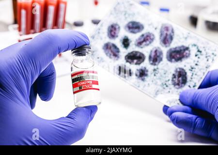 main du pharmacien avec un gant de latex tenant le vaccin contre la variole, avec photo du virus de la variole en arrière-plan Banque D'Images