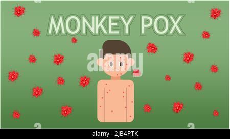 Monkeypox concept, Illustration de la monkeypox peau urticaria, vecteur d'une personne avec la monkeypox sur leur corps. Illustration du virus de la variole du singe Banque D'Images