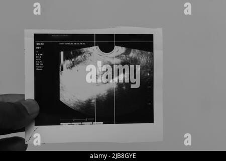 les femmes enceintes sonogramme avec un arrière-plan flou à partir d'un angle plat Banque D'Images