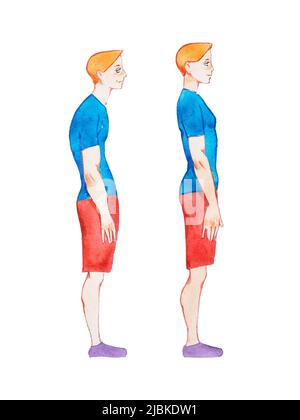 Illustration aquarelle de personnes avec la bonne posture et la mauvaise posture. En comparaison, les hommes et les femmes ont une colonne vertébrale normale et une colonne vertébrale malade anormale. Banque D'Images