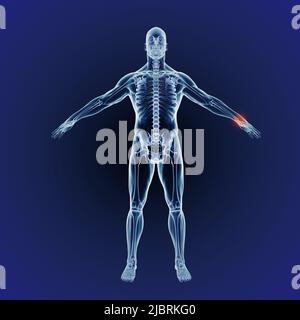 Douleurs au poignet et à l'inflammation. Quand l'inflammation frappe. Représentation CGI complète du corps humain indiquant la structure squelettique. Banque D'Images