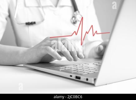 Médecin utilisant un ordinateur portable pour lire les résultats d'électrocardiogramme, en vérifiant les signes de maladies cardiaques. Problèmes cardiovasculaires, anomalie concept de détection. Noir et blanc. Photo de haute qualité Banque D'Images
