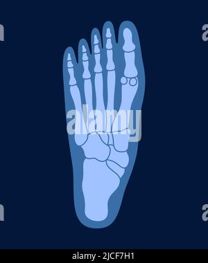 Rayons X des os du pied humain. Illustration du vecteur de rayons X de l'anatomie de l'articulation humaine. Illustration de Vecteur