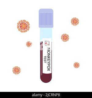 Tube à essai, échantillon de sang avec test positif pour le virus de la variole du singe et cellules virales isolées sur fond blanc. Illustration vectorielle. Illustration de Vecteur