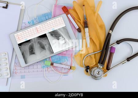 Une fois les stimulateurs cardiaques installés, le thorax à rayons X et l'électrocardiogramme de la courbe sont générés dans la vue numérique de la tablette Banque D'Images