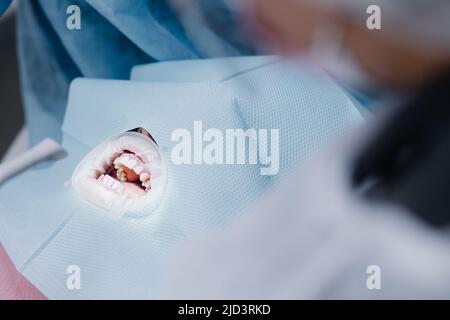 Dents blanches du patient avant l'intervention dans le cabinet dentaire. Photo de haute qualité Banque D'Images