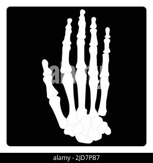 Icône de glyphe à rayons X, médecine et santé, graphiques vectoriels de signes radiologiques, motif Uni sur fond blanc Illustration de Vecteur