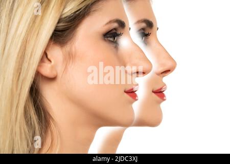 Jeune femme avant et après une chirurgie plastique du nez sur fond blanc. Banque D'Images