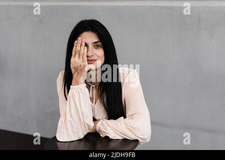 La femme géorgienne avec des timbres de pigmentation de vitiligo sur les mains couvre son visage avec ses mains. Style de vie avec les maladies saisonnières de la peau Banque D'Images