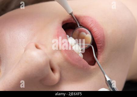 Vérification dentaire dans la clinique dentaire. Dentiste examinant les dents du patient à l'aide d'un miroir dentaire pendant le contrôle dentaire Banque D'Images