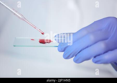Gros plan d'un travailleur de laboratoire méconnaissable en gants de caoutchouc qui dépose un échantillon de sang sur une lame de microscope tout en effectuant un test sanguin pour diagnostiquer un traitement Banque D'Images