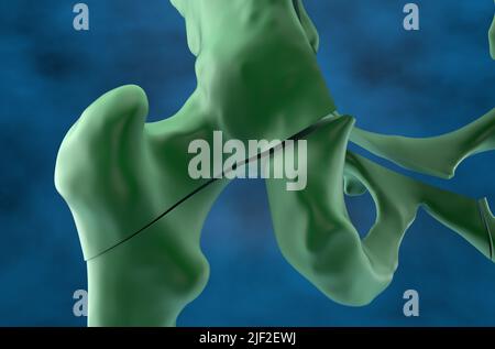 Fracture du bassin et du fémur dans l'ostéoporose - vue rapprochée 3D illustration Banque D'Images