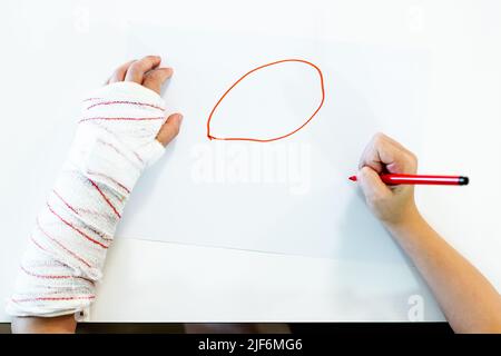 De dessus court petit garçon non reconnaissable avec bras cassé dans le bandage en plâtre dessin cercle avec marqueur rouge en étant assis à la table le week-end d Banque D'Images