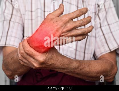 Inflammation dans l'articulation du poignet du vieil homme asiatique. Concept de douleur articulaire ou arthrose. Banque D'Images