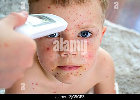 Vaccination naturelle. Maladie contagieuse. Banque D'Images