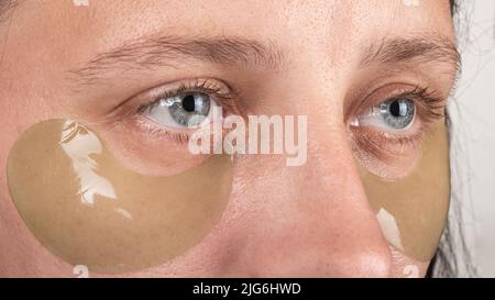 femme avec des taches oculaires gros plan, soins de beauté de peau. Banque D'Images