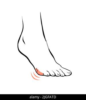 Dessinez la ligne de la jambe femelle avec une douleur problématique. Beauté et santé des pieds. Illustration de contour sur fond blanc Banque D'Images