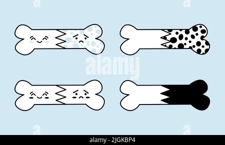 Ensemble d'ostéoporose détruit les os. Eléments osseux orthopédiques pour la Journée mondiale de l'ostéoporose. Bonne santé osseuse vs triste malade Illustration de Vecteur