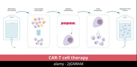 Thérapie cellulaire CAR-T. Les cellules T du récepteur de l'antigène chimérique sont des cellules T qui ont été génétiquement modifiées pour être utilisées en immunothérapie Illustration de Vecteur