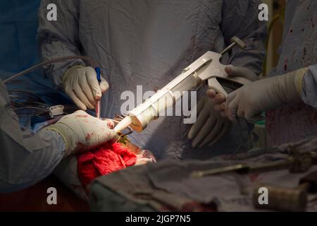 Un chirurgien et le personnel du NHS effectuent une chirurgie du genou, également connue sous le nom d'arthroplastie, dans un hôpital du NHS. Banque D'Images