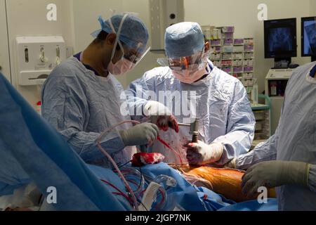 Un chirurgien et le personnel du NHS effectuent une chirurgie du genou, également connue sous le nom d'arthroplastie, dans un hôpital du NHS. Banque D'Images