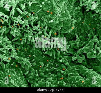 La variole du singe. Micrographe électronique par transmission colorisée des particules matures extracellulaires du virus Nipah (rouge) près de la périphérie d'une cellule VERO infectée (bleu et vert). Image capturée à l'installation de recherche intégrée NIAID à fort Detrick, Maryland. Crédit NIAID la variole est une maladie virale infectieuse qui peut se produire chez les humains et certains autres animaux.les symptômes incluent la fièvre, les ganglions lymphatiques enflés et une éruption qui forme des cloques et se décroûte ensuite. Le délai entre l'exposition et l'apparition des symptômes varie de 5 à 21 jours. La durée des symptômes est généralement de 2 à 4 semaines. Banque D'Images