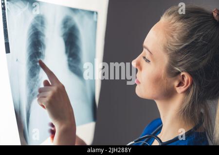Concept de soins de santé. Jeune femme caucasienne, assez blonde - pneumologue - regardant une radiographie pulmonaire éclairée. Photo de haute qualité Banque D'Images