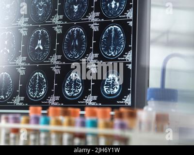 Recherche sur la maladie d'Alzheimer et la démence, image conceptuelle Banque D'Images