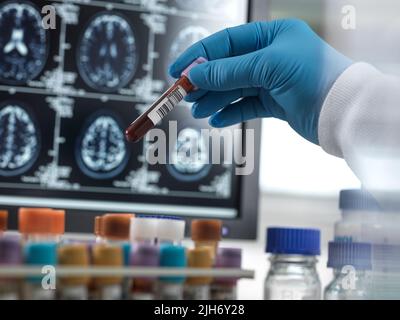 Recherche sur la maladie d'Alzheimer et la démence, image conceptuelle Banque D'Images