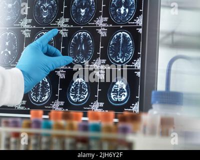 Recherche sur la maladie d'Alzheimer et la démence, image conceptuelle Banque D'Images