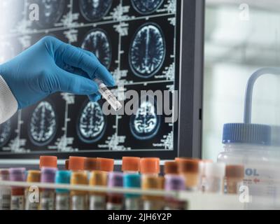 Recherche sur la maladie d'Alzheimer et la démence, image conceptuelle Banque D'Images