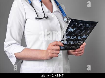 Médecin étudiant les résultats d'une acquisition CT ou IRM. Réalisation de diagnostics pour la détection de maladies ou de blessures. Femme analysant des images des organes internes du patient. Soins de santé, concept de médecine. Photo de haute qualité Banque D'Images