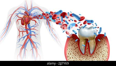 La carie dentaire et les maladies cardiaques comme un molaire malsain avec la parodontite due à un mauvais problème d'hygiène bucco-dentaire de santé comme une infection bactérienne dans le sang. Banque D'Images