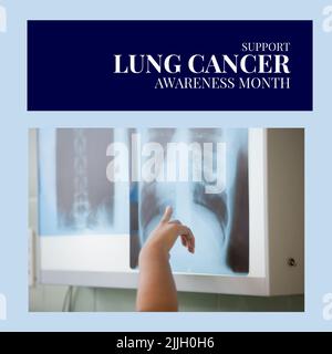 Image du concept de sensibilisation au cancer des poumons sur les mains d'un médecin caucasien montrant une radiographie Banque D'Images