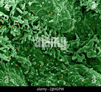 Fort Detrick, États-Unis. 26th juillet 2022. Un micrographe électronique à balayage colorisé du virus de la variole du singe (orange) à la surface des cellules VERO E6 infectées (vert) capturées à l'installation de recherche intégrée du NIAID a libéré 26 juillet 2022, à fort Detrick, Maryland. Crédit : NIAID/NIAID/Alamy Live News Banque D'Images