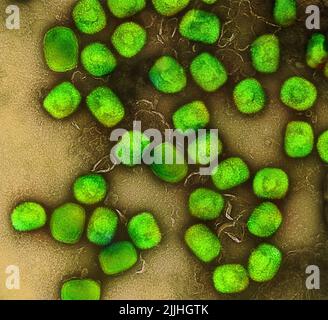 Fort Detrick, États-Unis. 26th juillet 2022. Un micrographe électronique à transmission colorisée des particules du virus de la variole du singe (vert) cultivées et purifiées à partir de cultures cellulaires capturées à l'installation de recherche intégrée de la NIAID a libéré 26 juillet 2022, à fort Detrick, Maryland. Crédit : NIAID/NIAID/Alamy Live News Banque D'Images