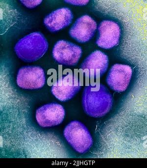 Fort Detrick, États-Unis. 26th juillet 2022. Un micrographe électronique à transmission colorisée des particules du virus de la variole du singe (violet) cultivées et purifiées à partir de cultures cellulaires capturées à l'installation de recherche intégrée de la NIAID a libéré 26 juillet 2022, à fort Detrick, Maryland. Crédit : NIAID/NIAID/Alamy Live News Banque D'Images