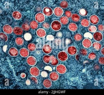 Fort Detrick, États-Unis. 26th juillet 2022. Un micrographe électronique par transmission colorisée des particules du virus de la variole du singe (rouge) trouvées dans une cellule infectée (bleue) cultivée en laboratoire et capturée à l'installation de recherche intégrée de l'INAID a libéré 26 juillet 2022, à fort Detrick, Maryland. Crédit : NIAID/NIAID/Alamy Live News Banque D'Images